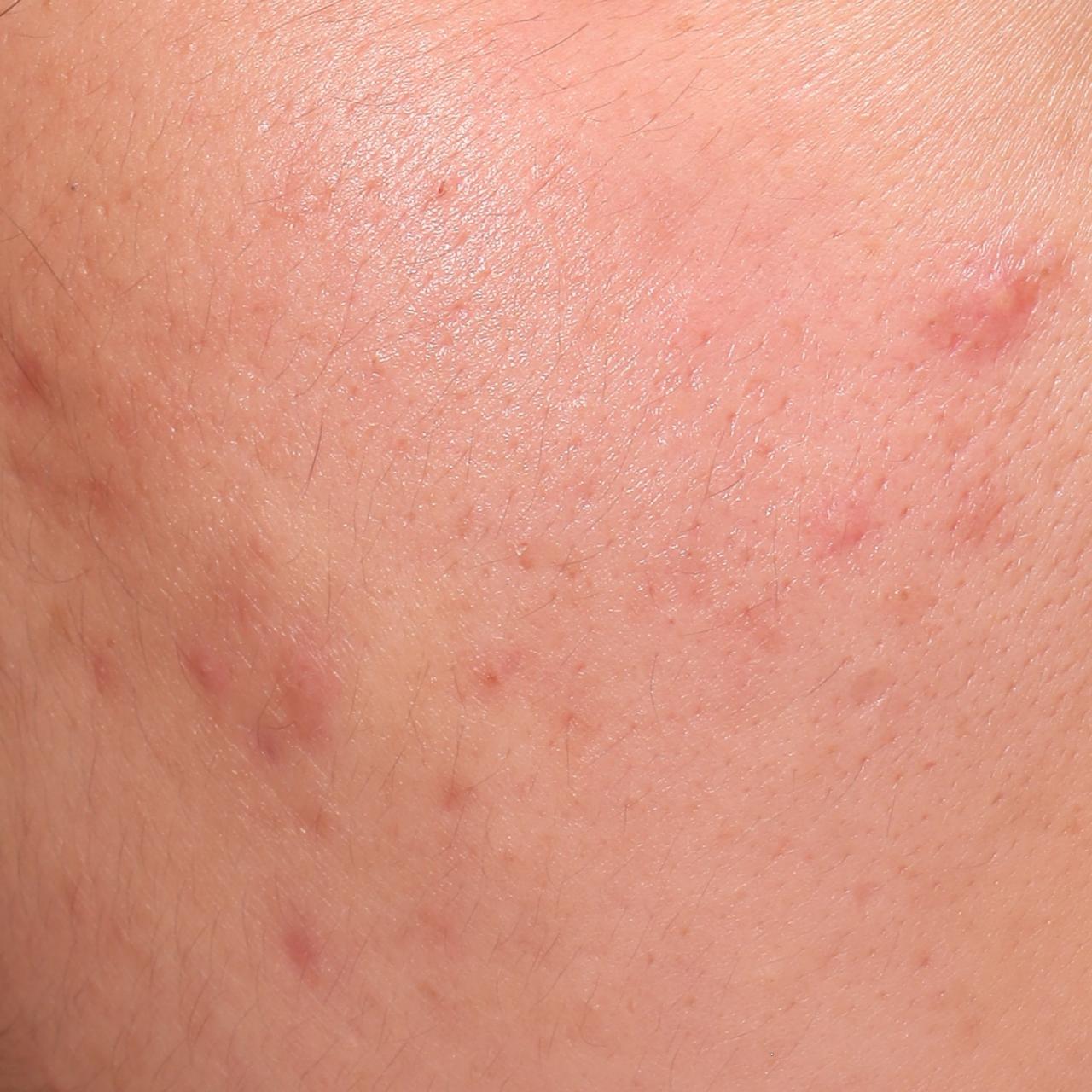 Fotografía original del estudio: imperfecciones, D0