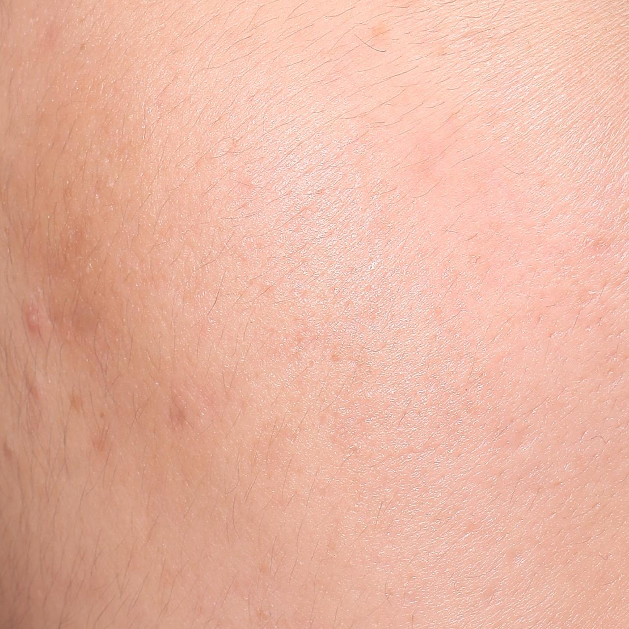 Fotografía original del estudio: imperfecciones, D28
